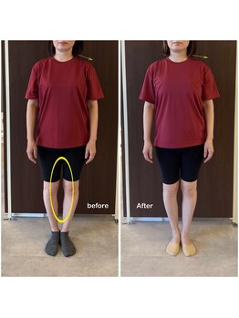 ニコディア(nico-dia)/全身矯正