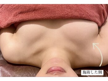 リラクゼーションエステ アジュール(Azur)/【施術1回】