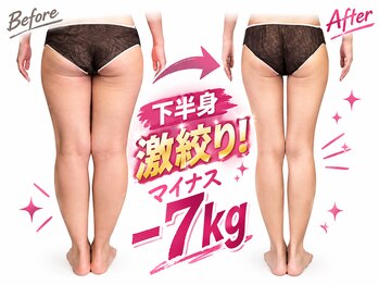 ナビ(NABI)の写真/脱・夕方のパンパン脚！プロの技で太もも＆ヒップのラインをすっきり美脚へ