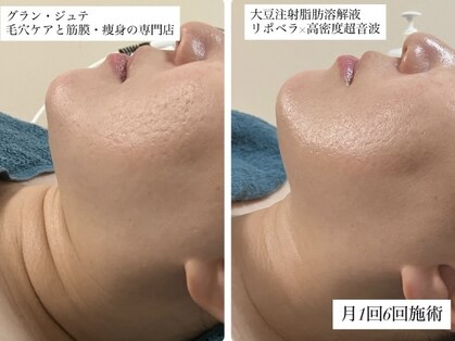 グラン ジュテの写真