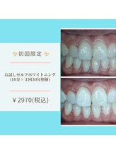 ライトビューティー 本八幡店(LIGHT BEAUTY)/もともと白い方も着色落とし♪