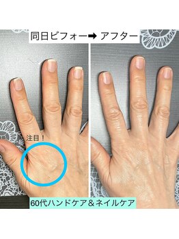 桃の木 吉祥寺店/保湿エステ後の潤い