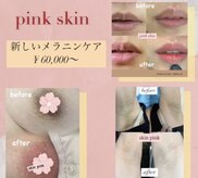 ピピランチェ ベッカン(PIPIRANCHE bekkan)