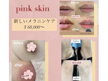 ピピランチェ ベッカン(PIPIRANCHE bekkan)