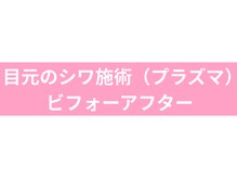 キーオブフェイス(Key of Face)/