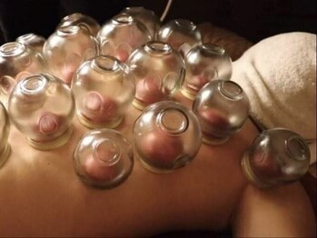 リラクゼーション マツウラの写真/【吸い玉+もみほぐし90分¥6000】血流促進×熟練手技で首肩コリを徹底改善◎施術後は全身が軽やかに…♪