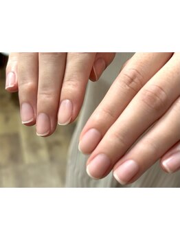 爪の悩みを解消できる（ケア含む）