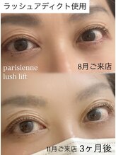 ウルル エルア(ululu 'elua)/パッチリお目めに