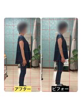 ラブリエ(LaBriller)/姿勢調整のビフォーアフター