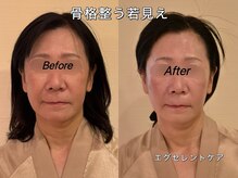 薬手名家 心斎橋店/お客様ビフォーアフター