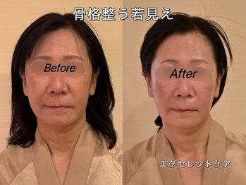 薬手名家 心斎橋店/お客様ビフォーアフター