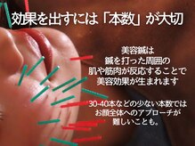 鍼灸チャンドラ(鍼灸Chandra)/当院は鍼の本数が多いです！