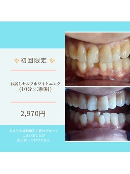 ライトビューティー 本八幡店(LIGHT BEAUTY)/セルフホワイトニング