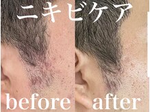 ルルアス(LUluas)/