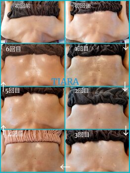 ティアラ(TIARA)/インスタ【@takara_tiara】