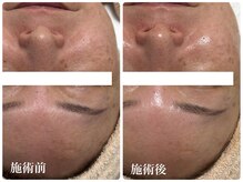 キーオブフェイス(Key of Face)/お悩み【肌にツヤがない】