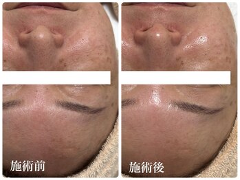 キーオブフェイス(Key of Face)/お悩み【肌にツヤがない】