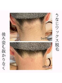 サロン ド モモ(salon de momo)/うなじデザインwax脱毛