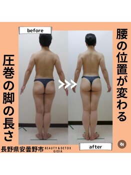 ジョイア 本店(Beauty＆Detox gioia)/腰の位置が変わる圧巻の脚の長さ