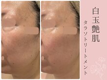 メシェリー(mecherie)の雰囲気（ミネラル成分と幹細胞美容液のマスクで赤みと引き締まりを実感）