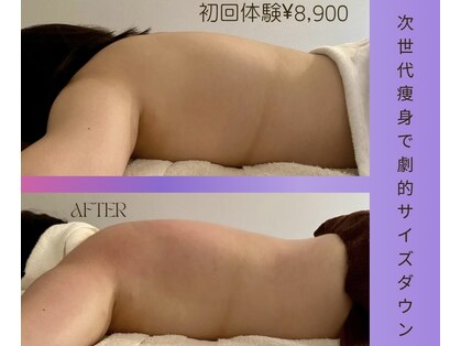 トータルエステサロン エステアンドメイク 錦糸町の写真