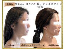 ビュート