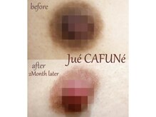 ジュエカフネ 広尾(JueCAFUNe)の雰囲気(独自の工程も加えたより効果の高いルメラ施術。自信のルメラ施術)