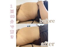 ミセル(MISEL2nd)/キープ力◎リピートNo.1最新痩身