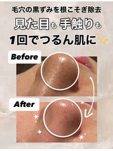 ビレボ マエバシ(BEREVO maebashi)/Before After