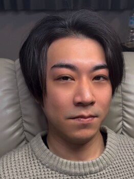 アルセ(Arce.)/しっかり生えてるからこその質感