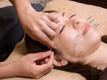 asmot鍼灸 整体院 代々木上原(asmot鍼灸 整体院)