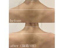 アムール 麻布十番(Amour)の雰囲気(筋肉の強張りに☆盛り上がった肩がスッと降りて軽やかに)