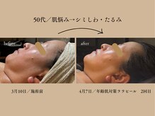 パンセリーノ(Panselinos)