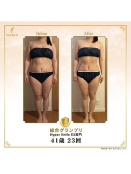ビレイ整骨院 西葛西の写真/本気で痩せたい貴女におススメ！しっかり汗をかいて、脂肪を撃退！とにかくスッキリします☆