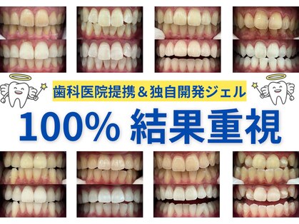 ホワイトニングサロン WHITEの写真