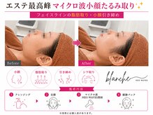 オリエンタルローザ 表参道(Oriental Rosa)/エステ最高峰切らずにお肉取り！