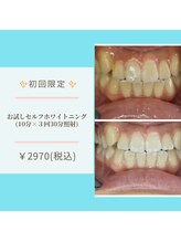 ライトビューティー 本八幡店(LIGHT BEAUTY)/セルフホワイトニング