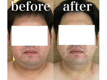 ルルアス(LUluas)/