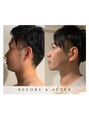 ゼロ アンド リセット(0ZERO&RESET) 【Before・After】