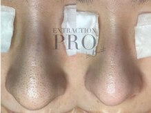 ルシェリア(Le cherien)/