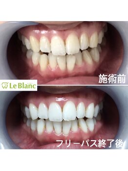 ルブラン 奈良店(Le Blanc)/美はお口元から!!