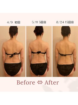 ファミーユ 名古屋店/【経過ビフォーアフター】