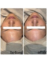 ディオーネ 春日井勝川店(Dione)/マーメイドセルトリートメント