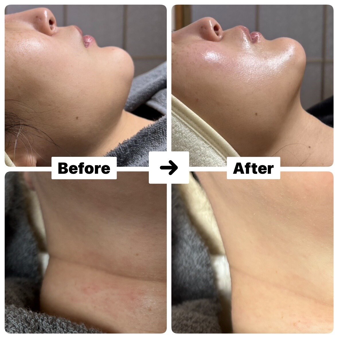 新潟市で毛穴ケアが人気のエステサロン｜ホットペッパービューティー