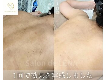 サロンドレナ 名駅店/ハーブピーリング サロンドレナ