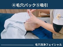 アポロ(Apollo)/【フェイシャル】【メンズ毛穴】