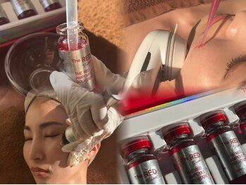 エステサロン ジョアアンジェ(joie ange)の写真/韓国美容レモンボトル進化版レッドショット導入!速攻小顔、老け顔脂肪へアプローチ!なりたい理想の輪郭に