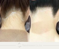 メンテナンス(Maintenance)