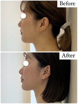 ラボーテヴェリテ(La Beaute Verite)/【お客様施術例】