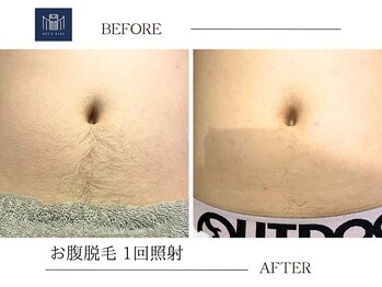 メンズメイド(Mens'Made)/before/after